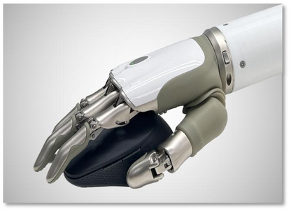 Intelligent Bionic Hand (Digital Intelligence)